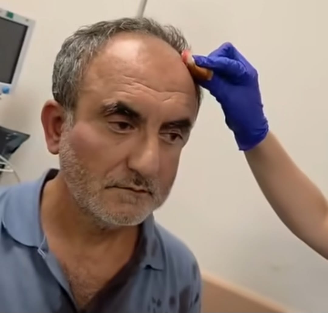 Samandağ’da Ekoloji Sözcüsüne Saldırı